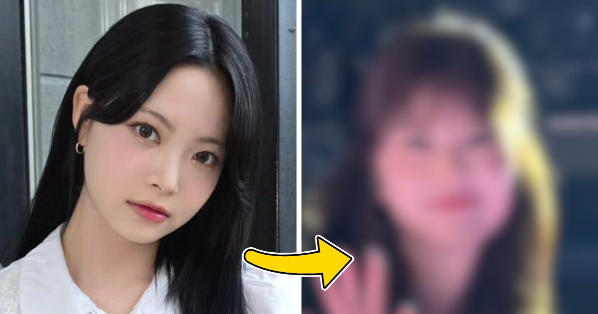 LE SSERAFIM Eunchae’s Recent Cosmetic Surgery Rumors Ignite Fierce Criticism 1 LE SSERAFIM Eunchae's Latest Alleged Cosmetic Procedure Sparks Scathing Comments