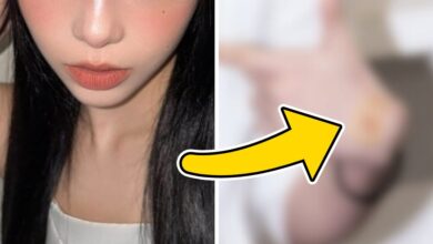 SM Entertainment Idol's Startling Bruises Raise Alarm 12 SM Entertainment Star's Shocking Bruises Trigger Concern