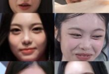 Ian faces criticism for smile lines