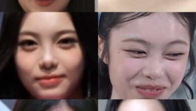 Ian faces criticism for smile lines