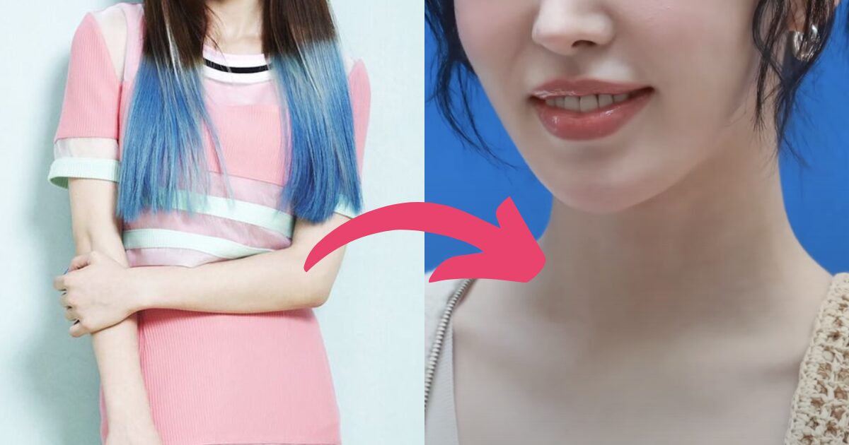Third-Generation Idol Faces Criticism Over Alleged Cosmetic Surgery Following Visual Changes 3 Wendy