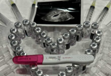 Actor Lee Ji Hoon's Wife Suffers Terrible Miscarriage