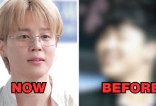 Jimin with alleged surgery comparison