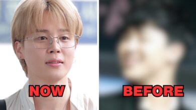 Jimin with alleged surgery comparison