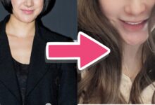 Seo In Young before and after nose implant removal