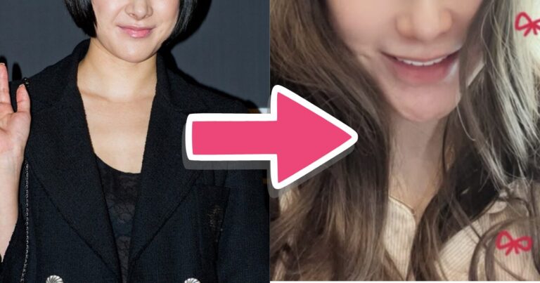 Seo In Young before and after nose implant removal