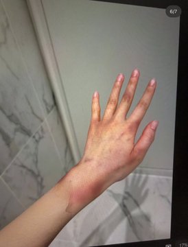 Her injuries. | theqoo