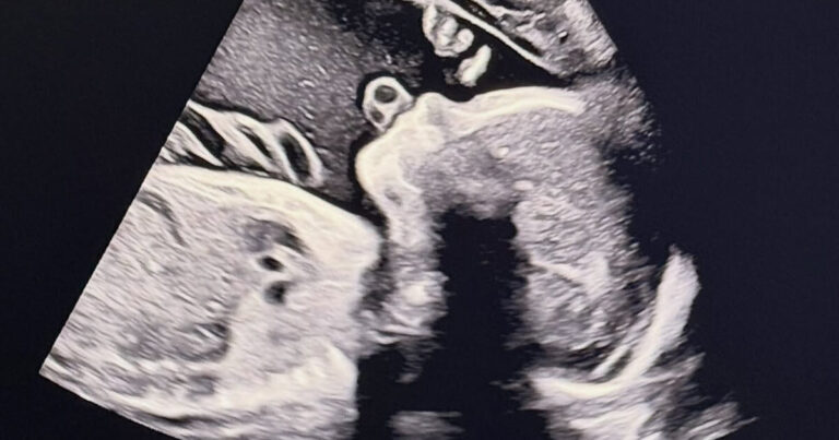 Song Seunghyun baby announcement