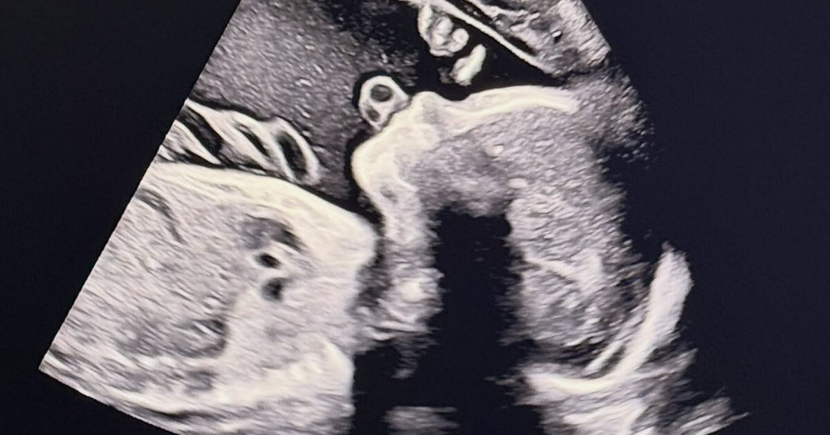 Former Idol and Actor Anticipates First Child Following Unexpected Retirement and Exit from Korea 1 Song Seunghyun baby announcement