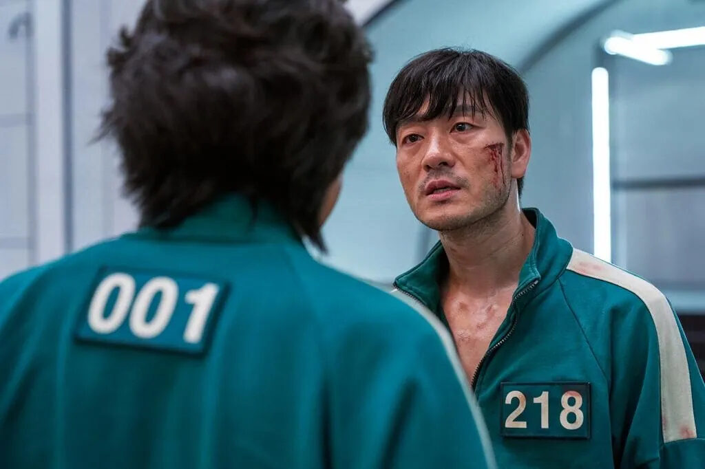Famous Actor’s Supposed Hair Transplant Makes Him Hard to Recognize 3 Park Hae Soo in Squid Game