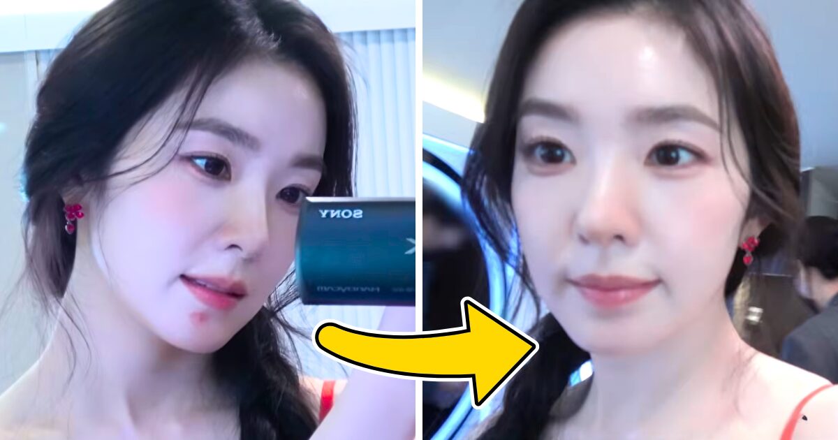 Red Velvet's Irene Removes Huge Pimple Live On Camera 1 Red Velvet's Irene Gets Rid Of Huge Pimple In Real Time... And Shows It All On Cam!