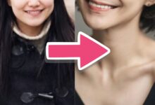 Shin So Yul transformation
