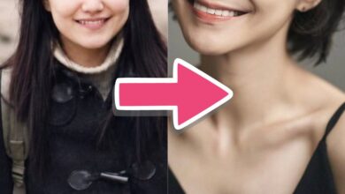 Shin So Yul transformation