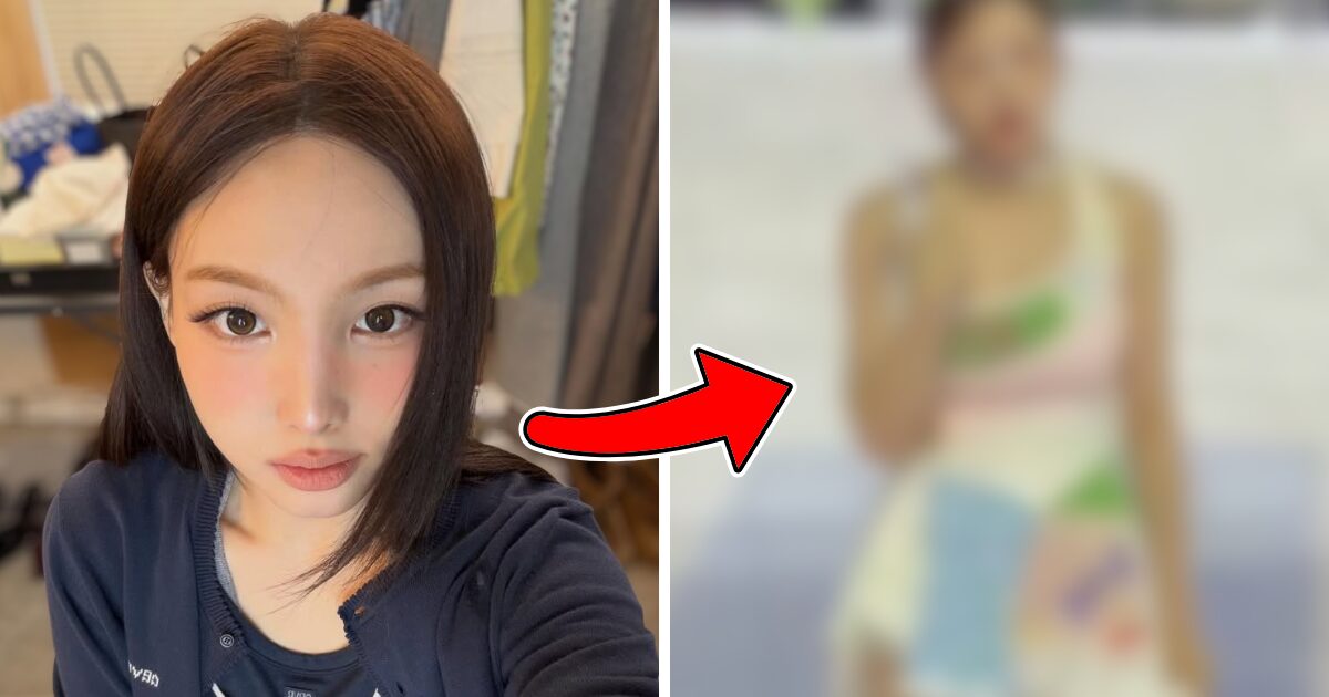 TWICE Nayeon's Shocking Appearance On Stage Sparks Massive Concerns
