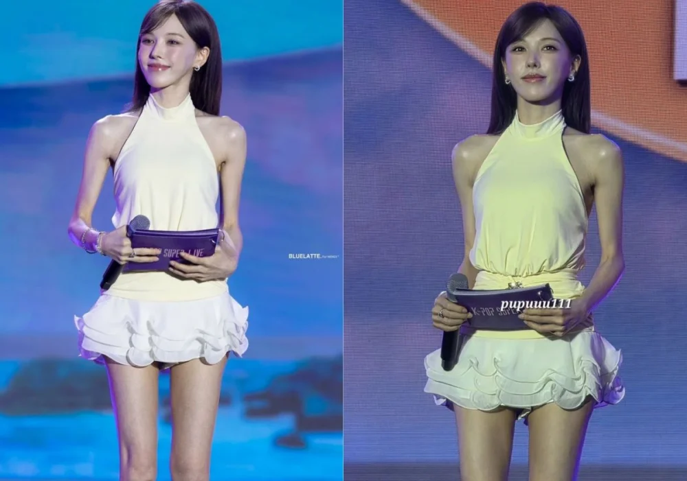 Red Velvet’s Wendy sparks fans' health concerns over extremely thin appearance 1 Red Velvet’s Wendy sparks fans' health concerns over extremely thin appearance